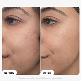 Clinical - Siero Retinaldeide duo PRO